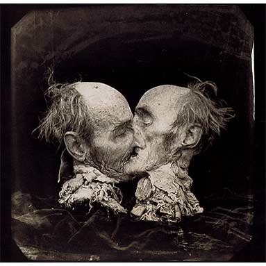 Joel-Peter Witkin: The Kiss (Le Baiser) New Mexico, 1982