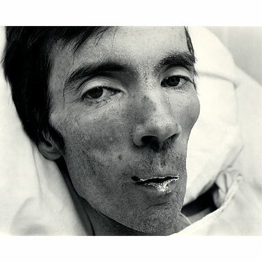Nicholas Nixon: Tom Moran, February 1988
